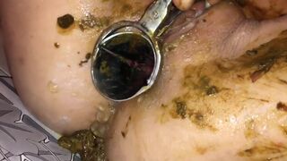 Asian amateur scat couple - video 5, ScatKings.com Scat Porn 18 ScatKings.com Scat Porn