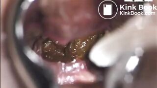 Einblick, ScatKings.com Scat Porn 13 ScatKings.com Scat Porn