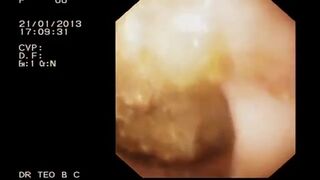 Look inside woman’s ass, ScatKings.com Scat Porn 16 ScatKings.com Scat Porn