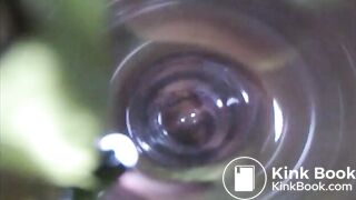 Observation Inside Anus, ScatKings.com Scat Porn 13 ScatKings.com Scat Porn