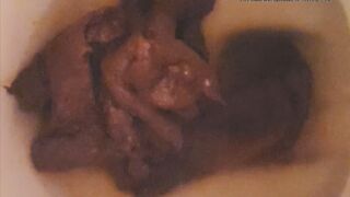 Unstoppable huge poop 2, ScatKings.com Scat Porn 1 ScatKings.com Scat Porn