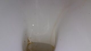 diarrhea - video 71, ScatKings.com Scat Porn 12 ScatKings.com Scat Porn