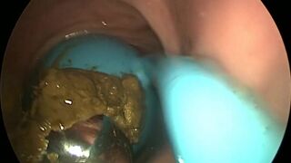 girls dirty vibrator removed, ScatKings.com Scat Porn 16 ScatKings.com Scat Porn